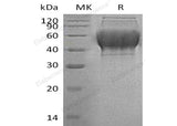 Recombinant Human TXNDC15 Protein (His Tag)