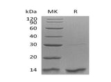 Recombinant Human Thioredoxin-2/TXN2 Protein (His Tag)