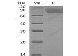 Recombinant Human Thrombopoietin/TPO Protein (His Tag)(Active)