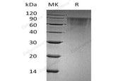 Recombinant Human THSD1/TMTSP Protein (His Tag)