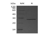 Recombinant Human Thymidylate Kinase/DTYMK Protein (His Tag)