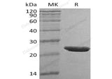 Recombinant Human TMPO Protein (His Tag)