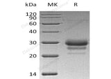 Recombinant Human TFPI2 Protein (His Tag)