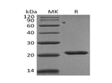 Recombinant Human TIMP2/TIMP-2 Protein (His Tag)