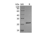 Recombinant Human TIMP-4/TIMP4 Protein (His Tag)