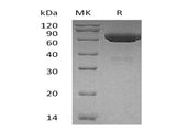 Recombinant Human tPA/PLAT Protein (His Tag)