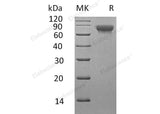 Recombinant Human SLAMF3/CD229 Protein (His Tag)