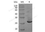 Recombinant Human TMX2/TXNDC14 Protein (His Tag)