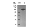 Recombinant Human Osteoprotegerin/TNFRSF11B Protein (Fc Tag)(Active)