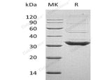 Recombinant Human TOLLIP Protein (His Tag)