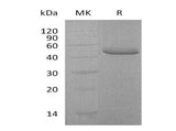 Recombinant Human TRAIL R2/TNFRSF10B Protein (Fc & His Tag)