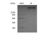 Recombinant Human TRAIL R3/TNFRSF10C Protein (Fc & His Tag)