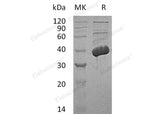 Recombinant Human MECR Protein (His Tag)