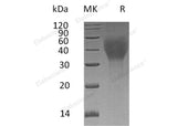 Recombinant Human TCblR/8D6A Protein (His Tag)