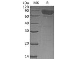 Recombinant Human TCblR/8D6A Protein (Fc Tag)