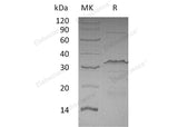 Recombinant Human CTCF Protein