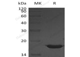 Recombinant Human YY1 Protein (His Tag)