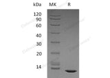 Recombinant Human TGFB2 Protein (Active)