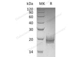 Recombinant Human Trefoil Factor 2/TFF2 Protein (His Tag)