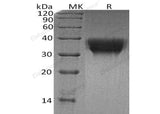 Recombinant Human TREM1 Protein (His Tag)