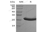 Recombinant Human TREML1/TLT-1 Protein (His Tag)