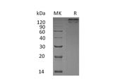 Recombinant Human TREML1/TLT-1 Protein (Fc Tag)