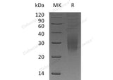 Recombinant Human TREM2 Protein (His Tag)