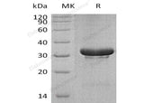 Recombinant Human TRIM5/RNF88 Protein (His Tag)