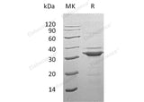 Recombinant Human Tropomyosin α-3 Chain/TPM3 Protein