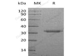 Recombinant Human PRSS22/BSSP-4 Protein (His Tag)