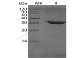 Recombinant Human Tryptase β-2/TPSB2 Protein (His Tag)