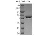 Recombinant Human WARS/TrpRS Protein (His Tag)