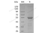 Recombinant Human TUBB4A Protein (His Tag)