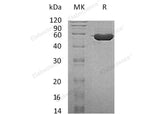 Recombinant Human TINAGL1 Protein (His Tag)