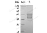 Recombinant Human TNFRSF1B/CD120b Protein (aa 288-461, His Tag)