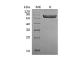 Recombinant Human TNFRSF1B/CD120b Protein (Fc Tag) 