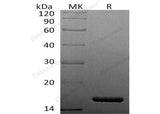 Recombinant Human TNF-alpha/TNFA Protein (aa 77-233, His Tag)(Active)