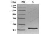 Recombinant Human TNF beta/TNFB Protein (Active)