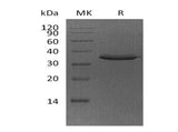 Recombinant Human FN14/TWEAKR Protein (Fc Tag)