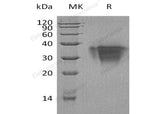 Recombinant Human TWSG1/TSG Protein (His Tag)