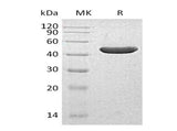 Recombinant Human INPP5A Protein (His Tag)