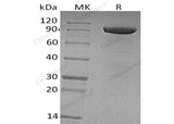 Recombinant Human Tie1 Protein (His Tag)