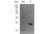 Recombinant Human LSM1 Protein (His Tag)