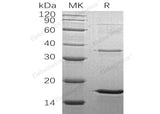 Recombinant Human LSM4 Protein (His Tag)