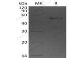 Recombinant Human USP14 Protein (His Tag)