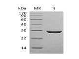 Recombinant Human UCHL1/PGP9.5 Protein (His Tag)