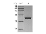 Recombinant Human UCHL3/UCH-L3 Protein (His Tag)