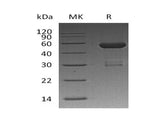 Recombinant Human UBAP1 Protein (His Tag)