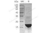 Recombinant Human UBE2B/HR6B Protein