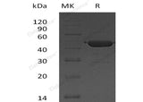 Recombinant Human UBE2G2 Protein (GST Tag)